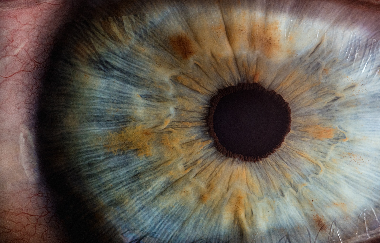 Cataracte: Comprendre, prévenir et traiter l’opacification du cristallin pour retrouver une vision claire